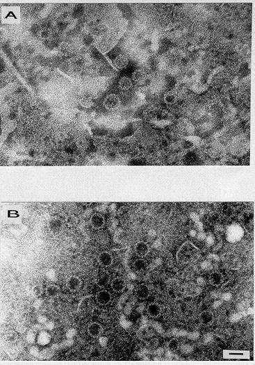 Purified Human papillomavirus Virus-like particles = VLPs as SUBUNIT Vaccines HPV6 VLPs purified from insect cells infected with a HPV6 L