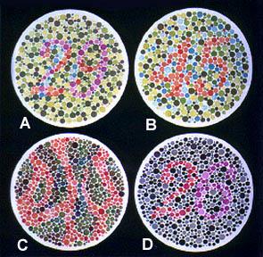 Color Blindness In Humans: An X-Linked Trait Numbers That You Should See If You Are In One Of The Following Four Categories: [Some Letter Choices Show No Visible Numbers] Sex-Linked Traits: 1.