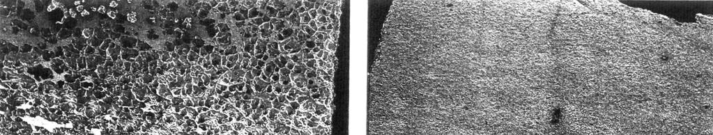 Theory of Interfacial Porosity: #1 Volumetric shrinkage of bone cement during polymerization