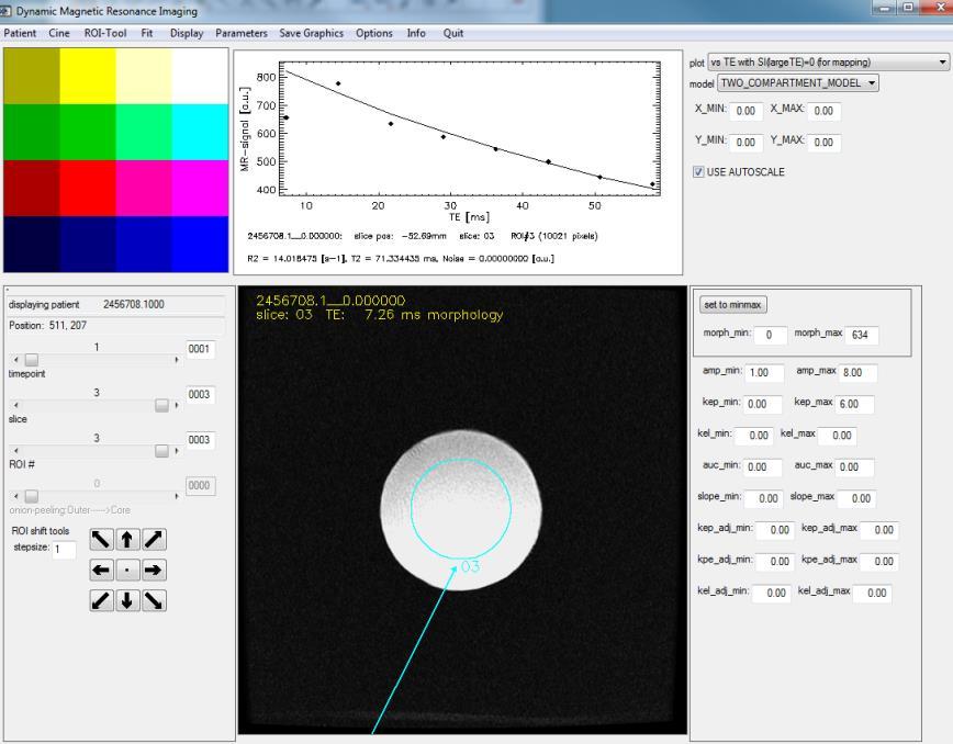 Figure 3.3: Screenshot of the software program, H.A.N.D, used to measure the T2 
