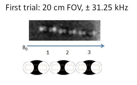 This effect is illustrated in Figure 4.3 for image data acquired in this project, where sagittal views of 3 seeds from two UTE image acquisitions are shown. The FOV of the first trial (Figure 4.