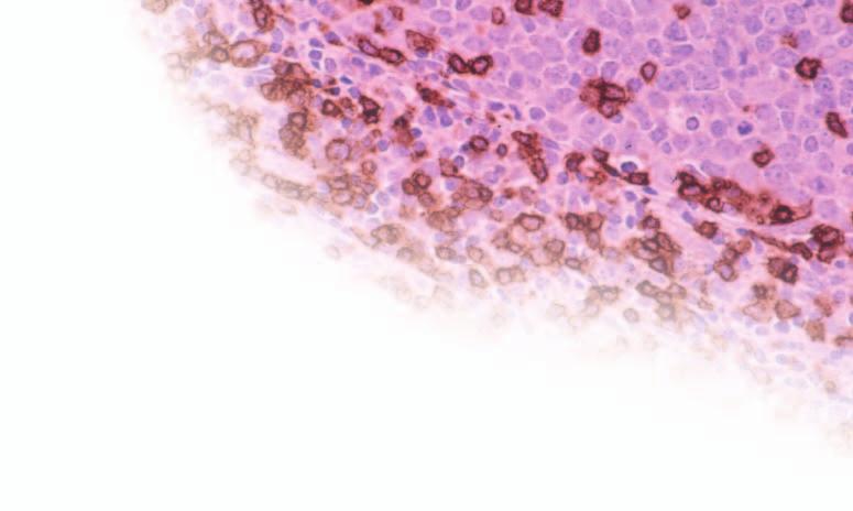 with the flexibility to match your research and application needs. Plus DNP Systems Designed for biotin-free chromogenic detection in IHC and ISH applications.