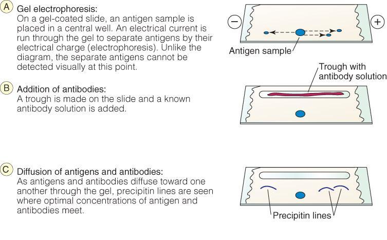 III- Electro-Immnodiffusion In electro-immunodiffusion, diffusion is combined with electrophoresis Electrophoresis separates antigen molecules according