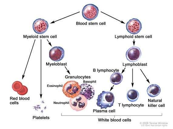 Myeloma Description Multiple myeloma is a B-cell malignancy derived from antibody-producing plasma cells in the bone marrow The proliferation of myeloma cells leads to