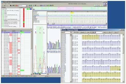 utype Dx Analysis Software features designed with HLA labs in mind utype Dx Analysis Software highlights To help ensure control of the sequencing data transfer process, utype Dx Analysis Software