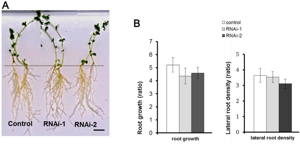 Supplementary Fig. 4 Growth phenotypes of SIP1 RNAi roots grown under non-symbiotic conditions. a Two transgenic plants from each of the control and RNAi groups were randomly selected for photograph.
