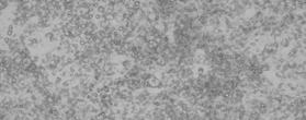 DIFFERENTIATION OF 3T3-L1 PREADIPOCYTES INTO ADIPOCYTES 1. Preadipocytes are plated sub-confluent in 3T3-L1 Preadipocyte Medium (cat# PM-1-L1) and shipped the next day via overnight delivery. 2.