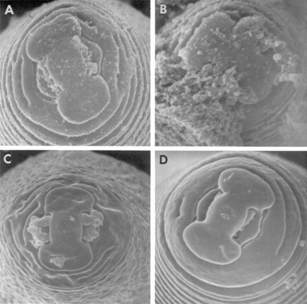 482 Journal of Nematology, Volume 18, No. 4, October 1986 FIG. 1. Second-stage juveniles ofmeloidogyne incognita prepared for scanning electron microscopy.