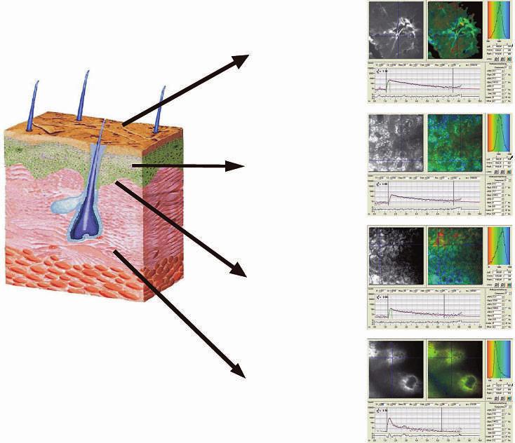 Stratum corneum τ 2 = 1.6 ns Stratum spinosum τ 2 = 2.3 ns Stratum basale τ 2 = 1.9 ns Dermis τ 1 <150 ps Fig. 3. Fluorescence decay kinetics and FLIM images from different tissue areas. and age.