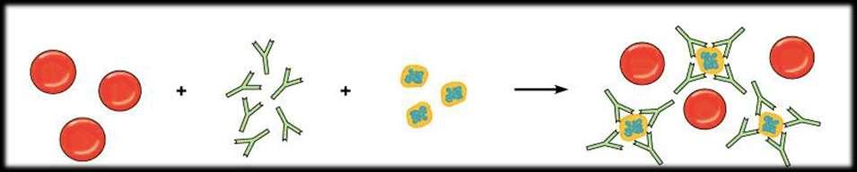 SOLUTION #4 - NEUTRALIZATION WITH SOLUBLE CD38 Reagent red cells DARA CD38 Easy to use, all antibodies detected Commercially