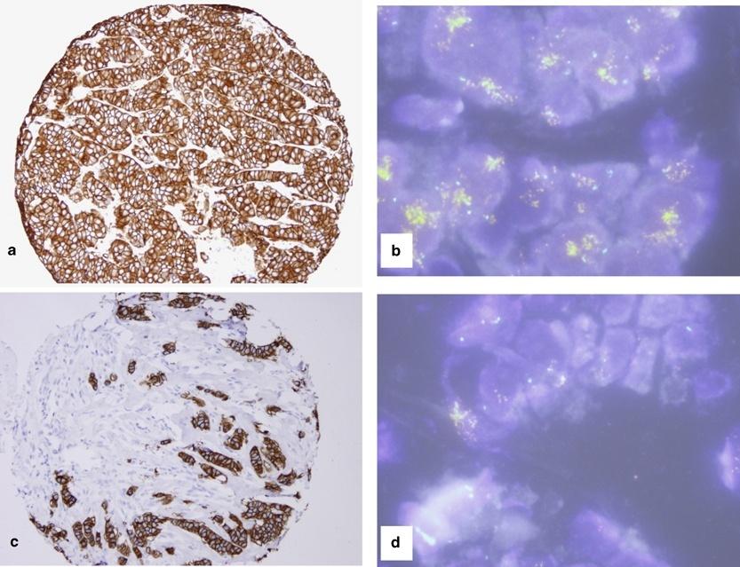 Cold Ischemia and Molecular Assay Results HER2 IHC and