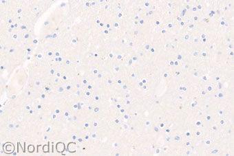 Fig 3b Insufficient CD45, LCA staining of the brain using same protocol as in Figs. 1b & 2b same field as in Fig. 3a.