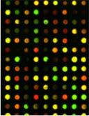 MULTIPLEXED MRM ASSAYS: RAPID VALIDATION OF CANDIDATE BIOMARKERS Candidate Biomarker list Literature Proteomics Transcriptomics Multiplexed MRM assay (up to 700 proteins) Biomarker verification
