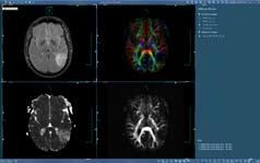 Medical Director of Neuroradiology & MRI Baptist Hospital Miami, FL The DynaSuite Neuro System is fast, intuitive and user friendly, generating complex data sets without labor intensive effort.