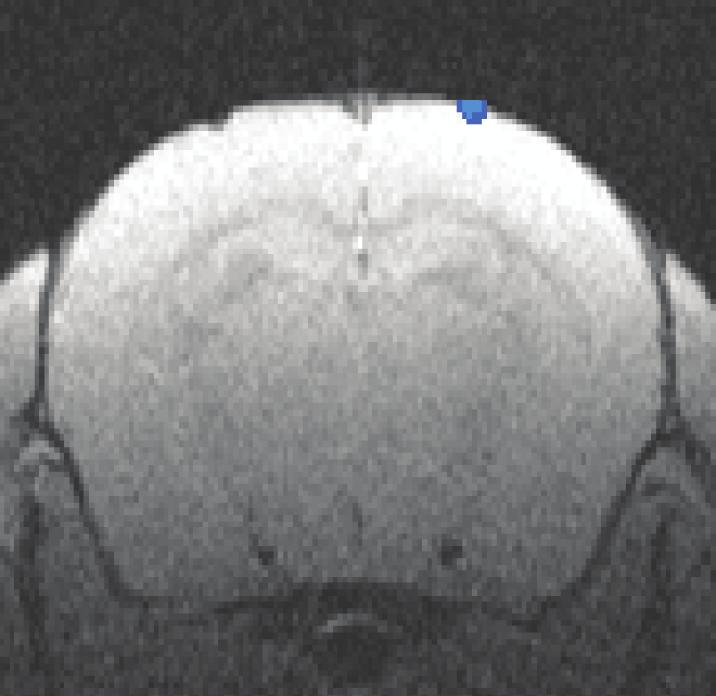 A Thy1-ChR2 mouse, high-resolution scan (decreases in MRI signal) Thy1-ChR2-B (0.
