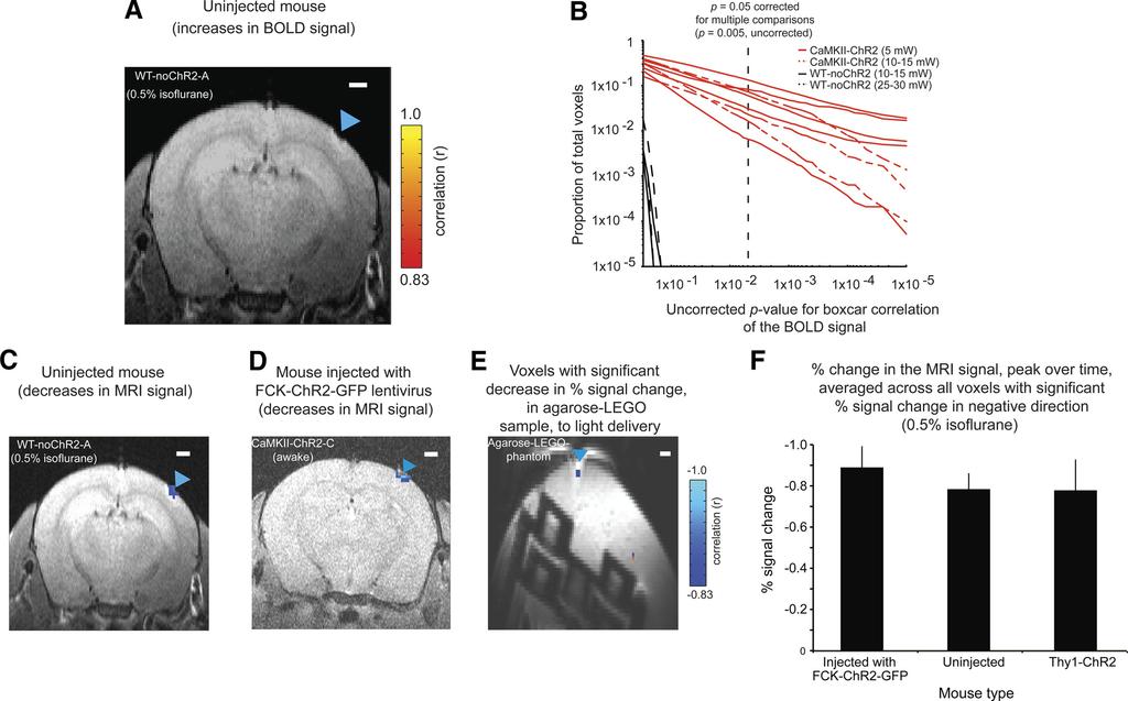 Innovative Methodology Opto-fMRI IN AWAKE MICE 1395 in fmri. The reason for this final dental cement step was to reduce distortion: Supplemental Fig.