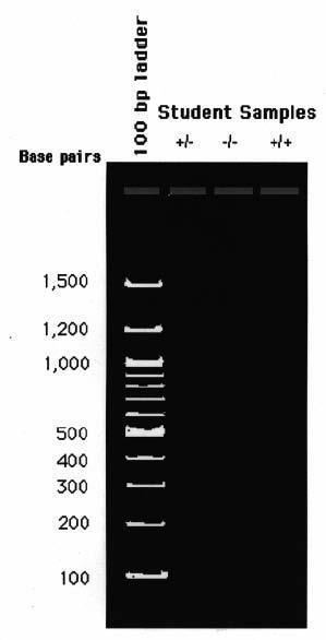 100 bp ladder shows bands but no sample bands are present. Reactions failed to produce amplification. This might result from: 1. Inadequate template amounts added to the reaction. 2.