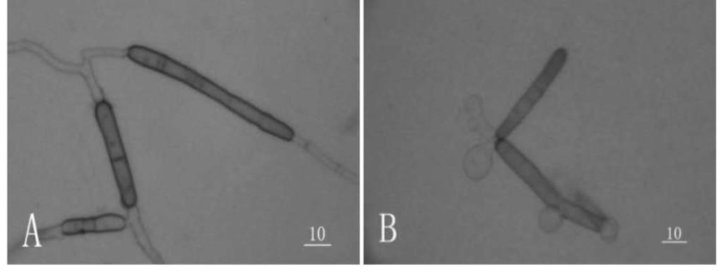 The inhibition of XN-1 filtrate against spore germination of C. cassiicola Note: The bar represents 10 µm Fig. 3 The effects of temperature on inhibition rate of culture filtrates against C.