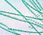 Kingdom Eubacteria Make up the larger of the two prokaryote kingdoms Generally are surrounded by