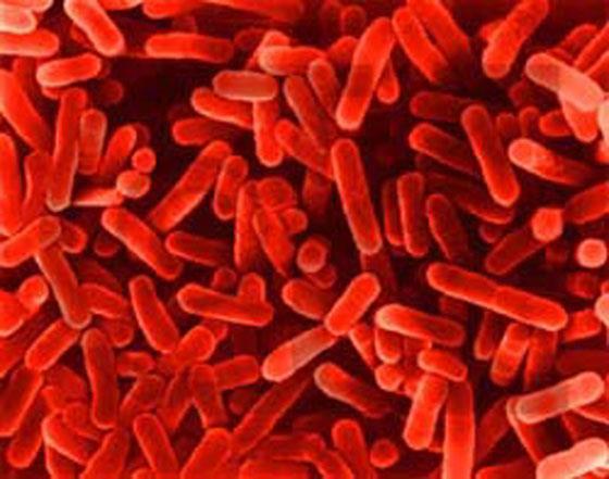 Bacteria and Technology 1) Food Preparation: Lactobacillus is used in making pickles, soy sauce, cheese, wine, yoghurt, etc 2) Bioremediation: Cleaning up toxic chemicals in