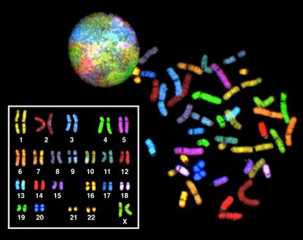Karyotype photograph that shows the complete diploid set of chromosomes grouped