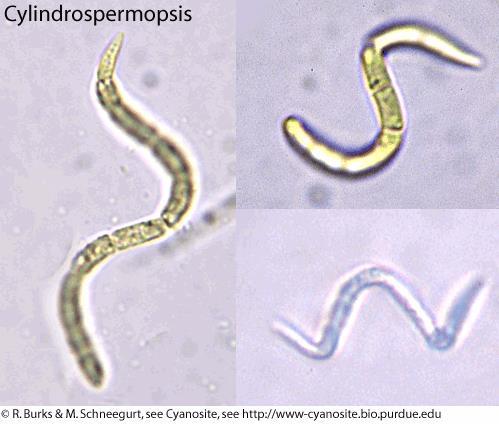 Cylindrospermopsis raciborskii (40%), suspended in water Toxin name: cylindrospermopsin Can cause liver damage and even death in humans (water supply)