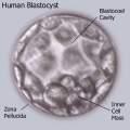 Stem cell harvesting: embryonic stem cells From the inner cell mass of the