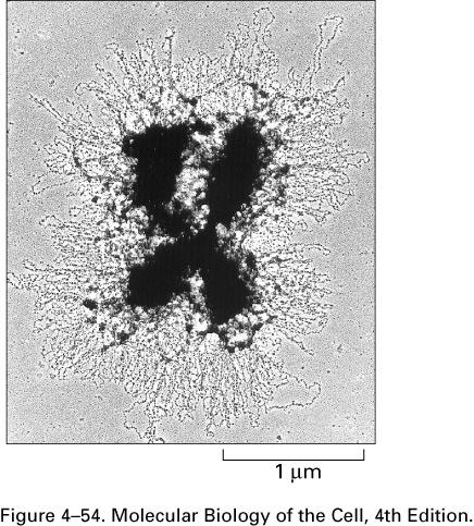 when visualized after gentle nuclear lysis by TEM