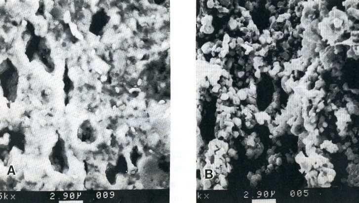 Nickel/YSZ Cermet preparation In most cases 1) NiO and YSZ; 2) NiO reduced in situ (porosity increases) Anode