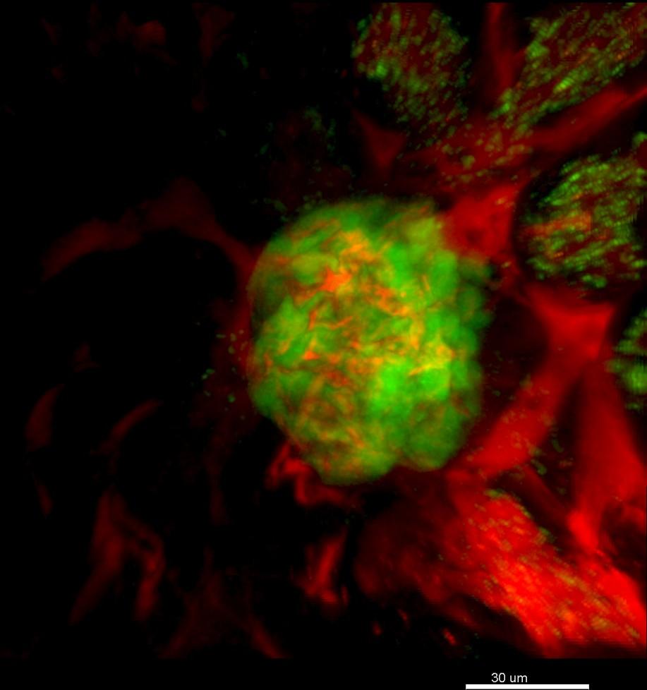 GFP-LABELED GLOMERULUS DEXTRAN-TEXASRED VESSELS INTACT KIDNEY FROM