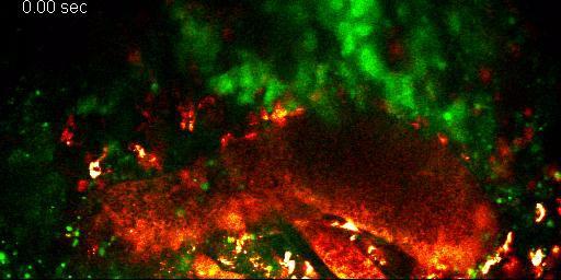 INTRAVITAL IMAGING DEXTRAN-TEXAS RED LABELED BLOOD VESSELS TUMOR CELLS LABELED