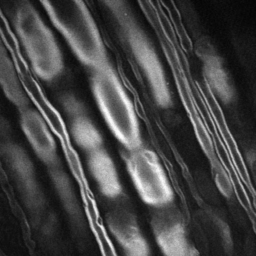 dorsal root nerve Image courtesy