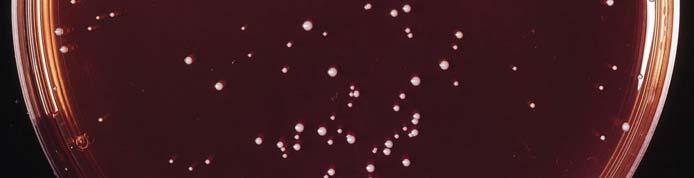 epidermidis (bottom right) : White colonies surrounded by a red halo (no mannitol fermentation) *Benchmark value refers to the expected