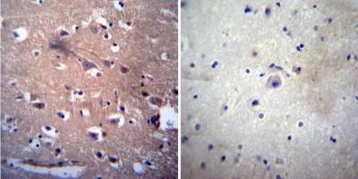 Immunohistochemistry-Paraffin: Acetylcholinesterase/ACHE Antibody (HR2) [NB300-528] - Both normal and cancer biopsies of deparaffinized human Brain tissue. Page 3 of 5 v.20.