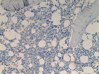 antibody is incubated before the H 2 O 2 block IHC