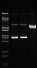 PCR: Interpreting Results Gel electrophoresis separates DNA fragments by size (number of base pairs in gene) Samples Ladder Potential is induced over the length of the gel, DNA is charged Larger