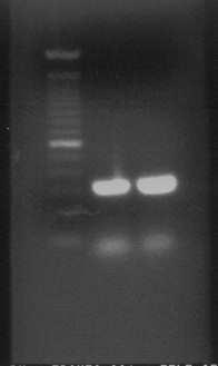 RT-PCR Results The two columns to the right are products