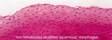 Anal canal Keratinized Stratified Squamous
