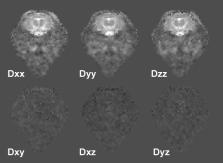 Development and Implementation of MR sequences and/or techniques Diffusion Weighted Imaging, Diffusion Tensor Imaging optimization of acquisition, minimization of tensor element variation
