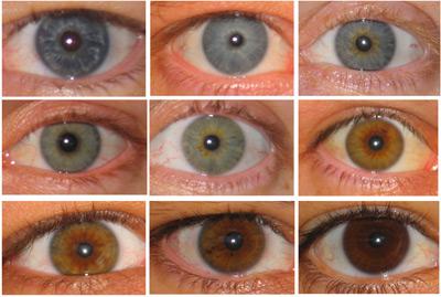 Differentiation at around the OCA2 gene OCA2 came up in Lecture 5 Was it a gene that is known to affect: (a) Type II diabetes susceptibility (b) Eye-color (c) Intelligence (d) Cystic-fibrosis