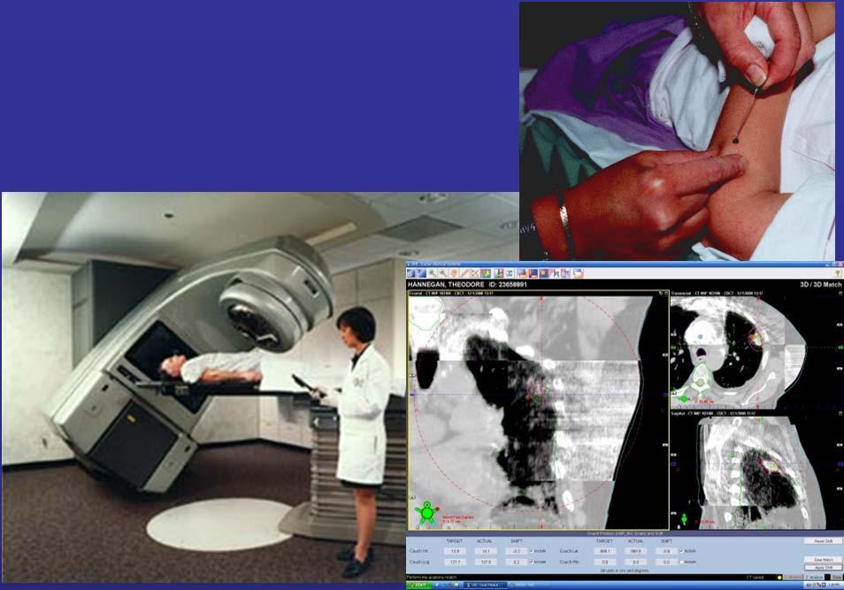 RT process Treatment preparation Treatment simulation Build a virtual patient model (reference