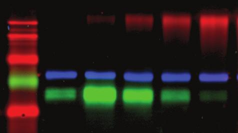 Fluorescence Visible Imaging Blue Excited DNA Dyes Visible Fluorescence Chemiluminescence UV Fluorescence Visible Imaging Blue Excited DNA Dyes
