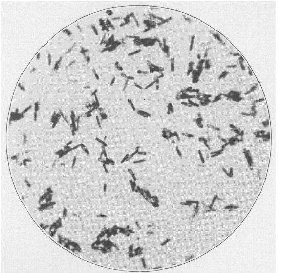Figure 1.1: Bacillus difficilis (now Clostridium difficile) grown for 48 hrs on a blood agar slant under alkaline pyrogallol.
