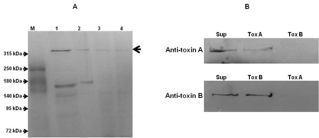 Figure 2.4-A: Polyacrylamide gel electrophoresis (PAGE) analysis of C. difficile toxins A and B purification by anion exchange and gel filtration chromatography.