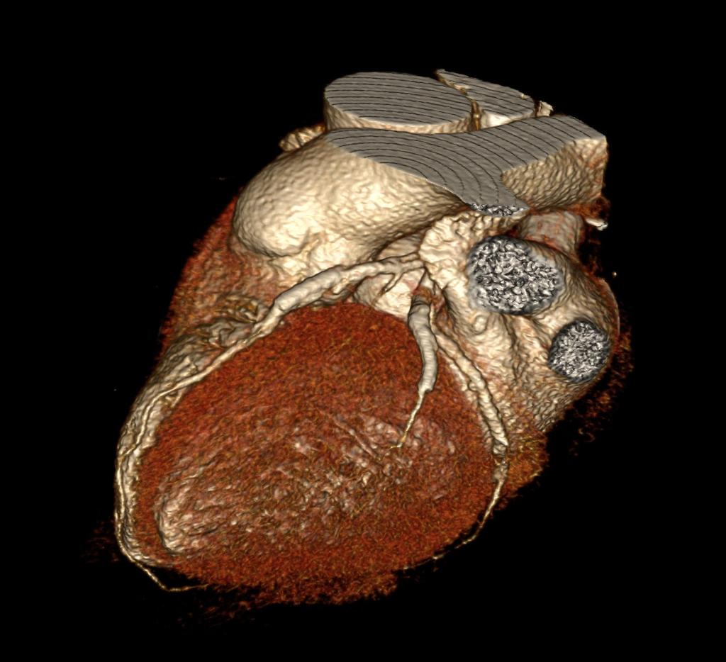 msv volumetric heart scan (dr.