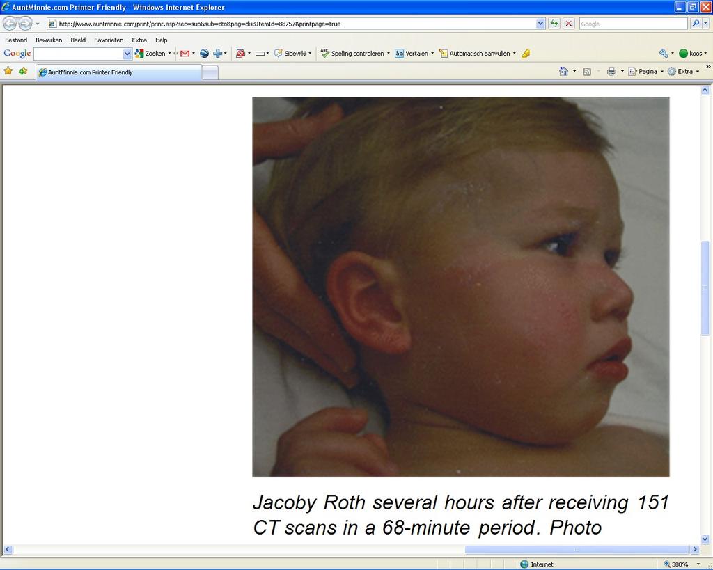 Badly performed AND repeated CT brain study The toddler