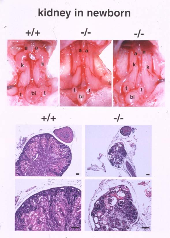 Kidney of a mouse embryo Nishinakamura R.
