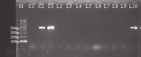 Figure 2. Lane M: 100 bp DNA Ladder. C1: Control negative. C2 ATCC control strain (Candida albicans ATCC 10231). L1 and L10 positive samples. L2, L3, L4, L5, L6, L7, L8, L9 negative samples Table 2.