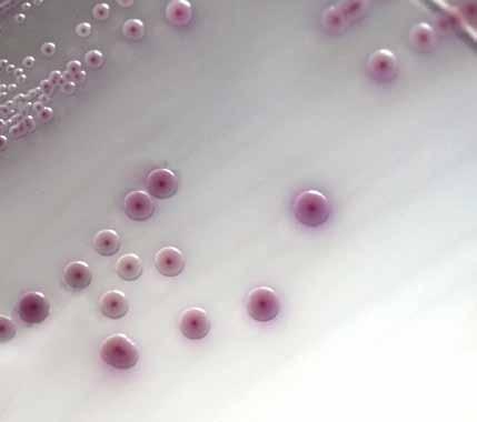 E. coli O157 produces smooth, pink to mauve colonies. Organisms other than E.