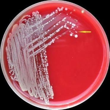 Burkholderia cepacia as an Objectionable Organism The primary hazard - those with cystic fibrosis (or predisposed to pneumonia) and the use of inhaled medications.